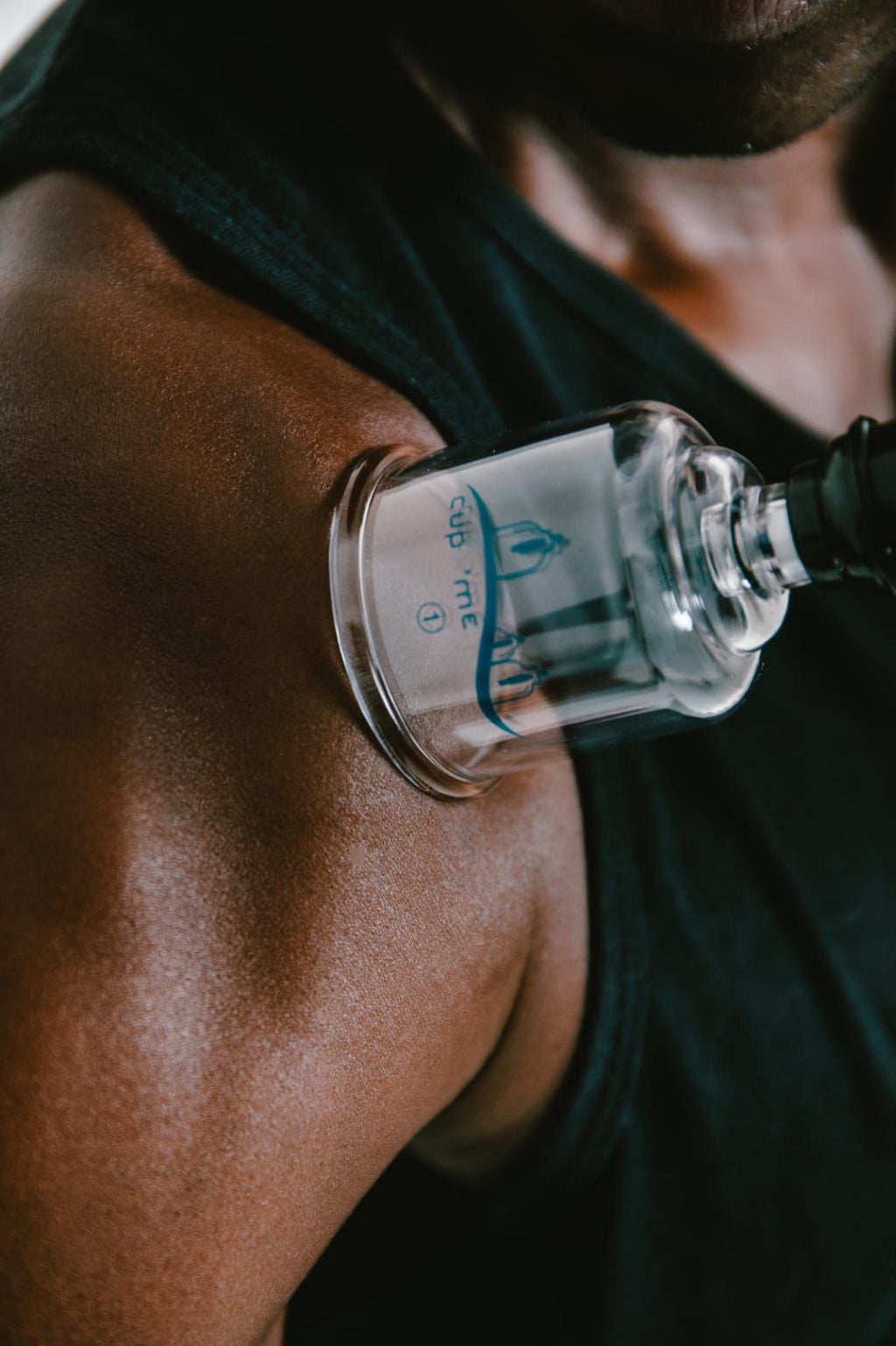 Malette XXL de 30 ventouses de cupping